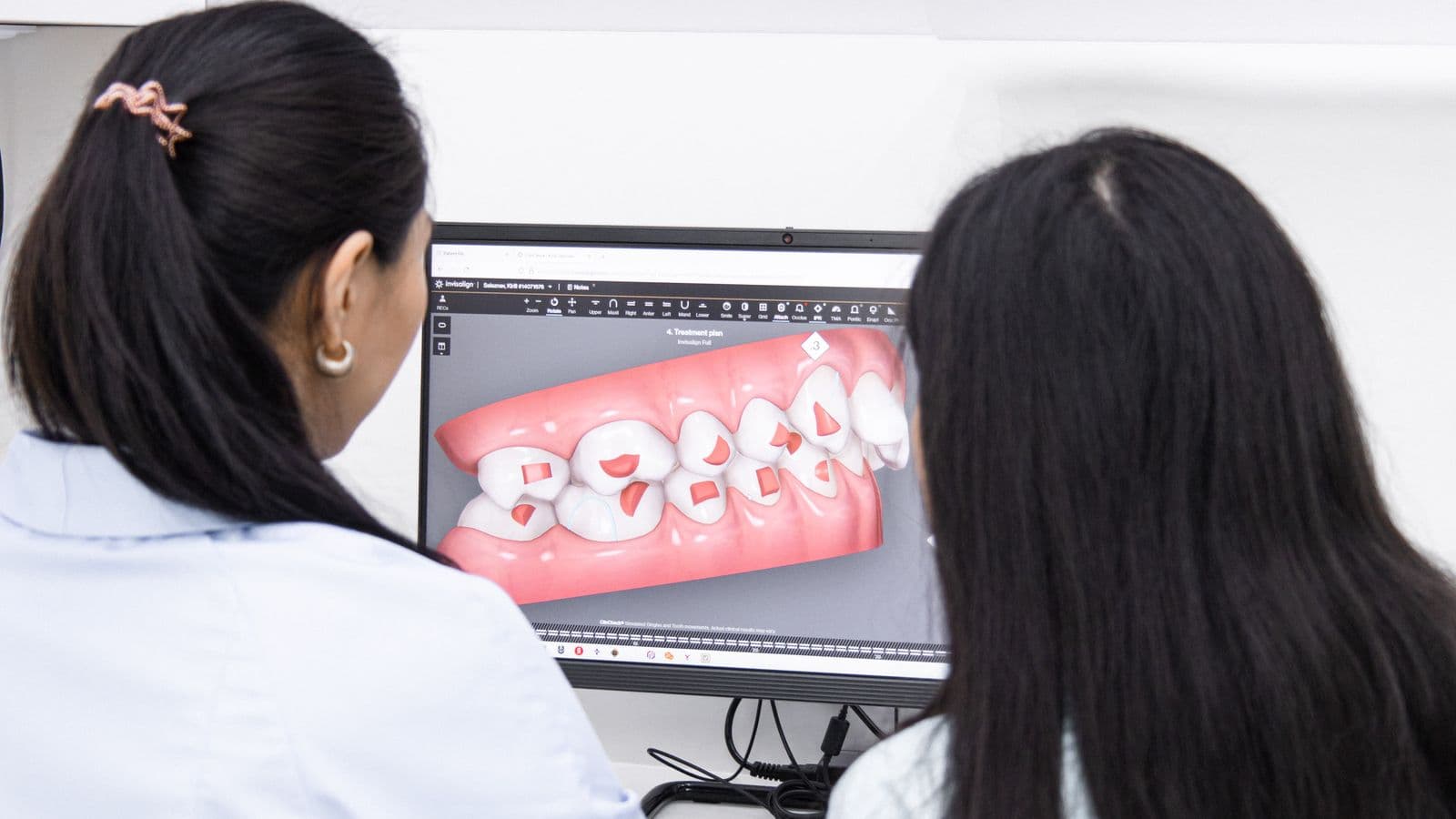 Diş hekimleri ekranda 3D dijital diş modelini inceliyor